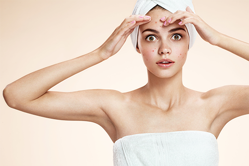 4 Adult Acne Mistakes You Could Be Making Right Now